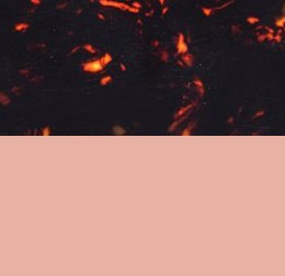 Tortoise meets Pink